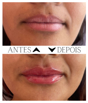 Micropigmentação Labial