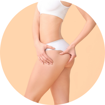 Carboxterapia